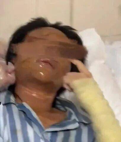 湖南一女主播被偽裝的包裹炸傷<strong></p>
<p>西鳳酒
</strong>，永州公安：正在核實(shí)具體情況:西鳳酒
