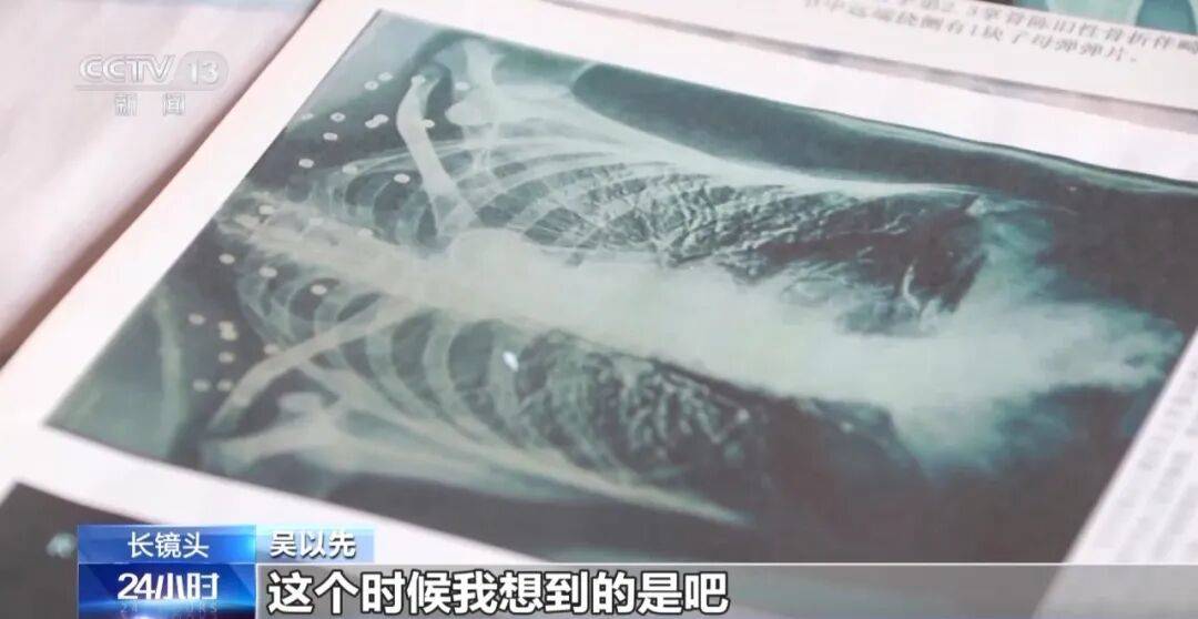 “老先生<strong></p>
<p>西鳳酒
</strong>，您把項鏈取下來再做CT”“你看是不是彈片”:西鳳酒
