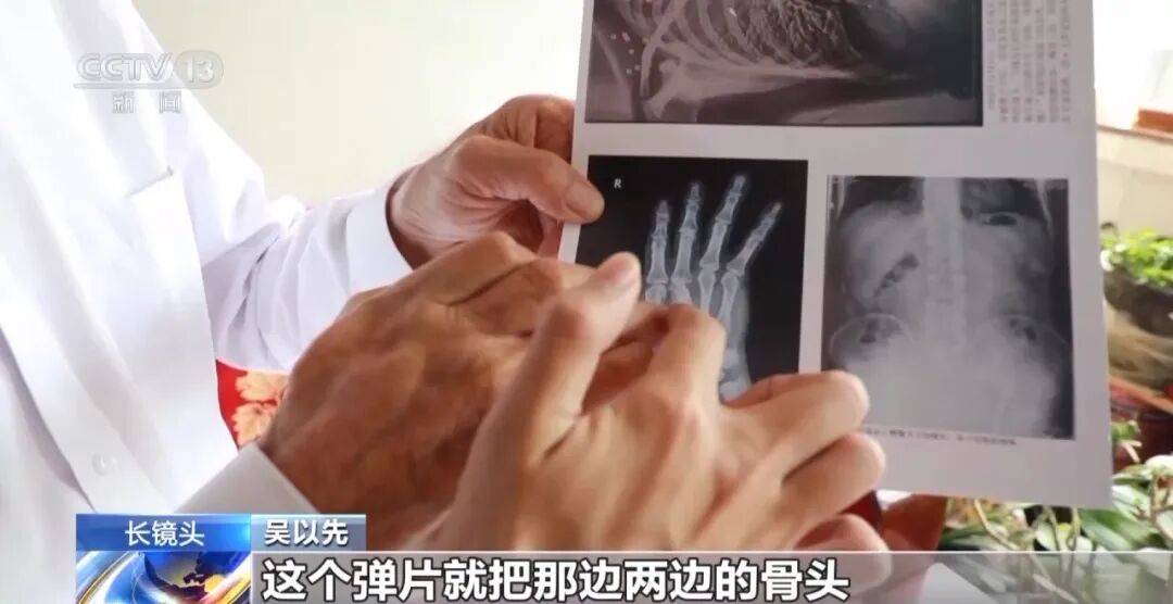 “老先生<strong></p>
<p>西鳳酒
</strong>，您把項鏈取下來再做CT”“你看是不是彈片”:西鳳酒
